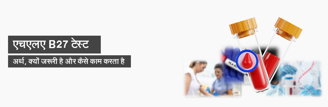 एचएलए B27 टेस्ट अर्थ, क्यों जरूरी है और कैसे काम करता है